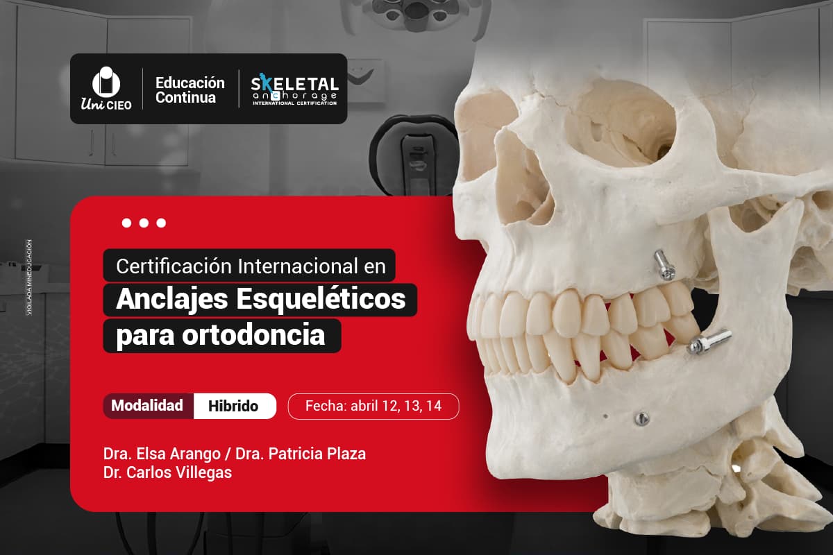 Certificación en Anclajes Esqueléticos para ortodoncia