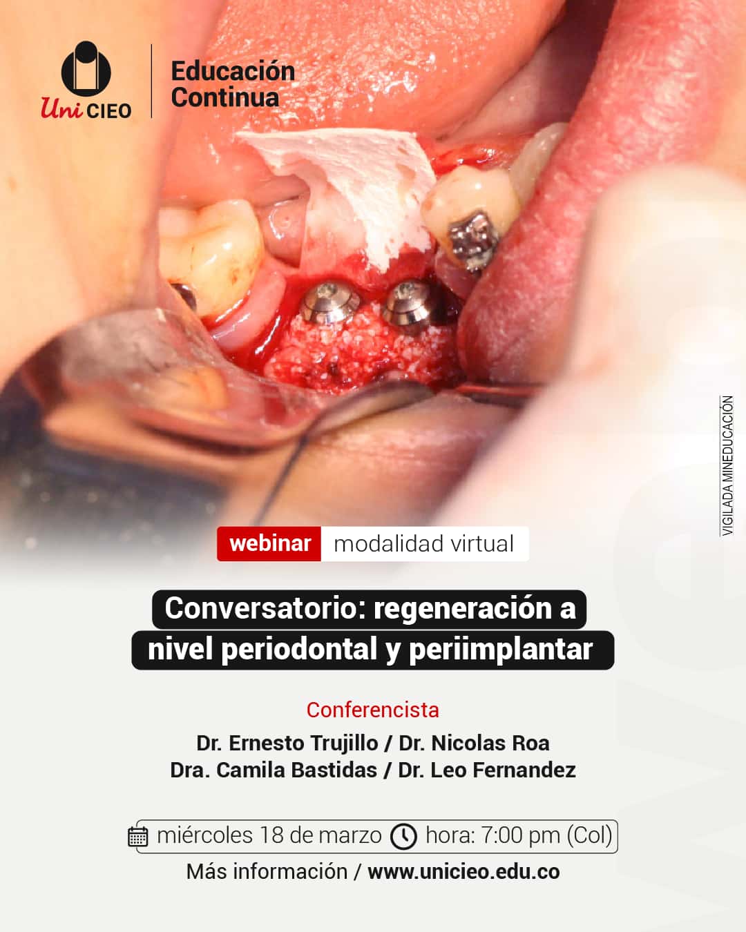 webinar-regeneracion-a-nivel-periodontal-y-periimplantar